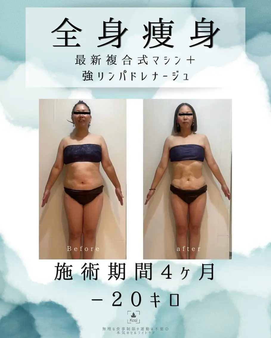 エステ 医療提携 肌管理痩身エステ池袋のエステ・リラクイメージ
