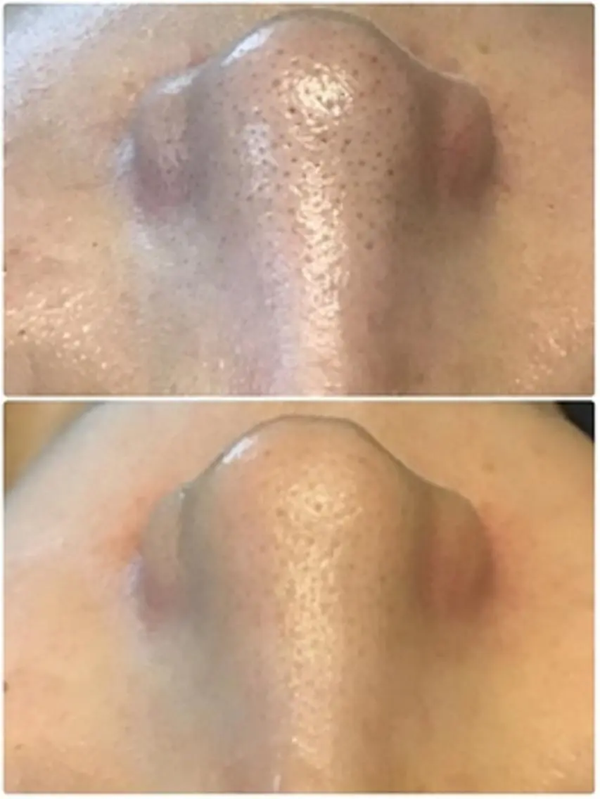 EYE LASH LAPISのエステ・リラクイメージ