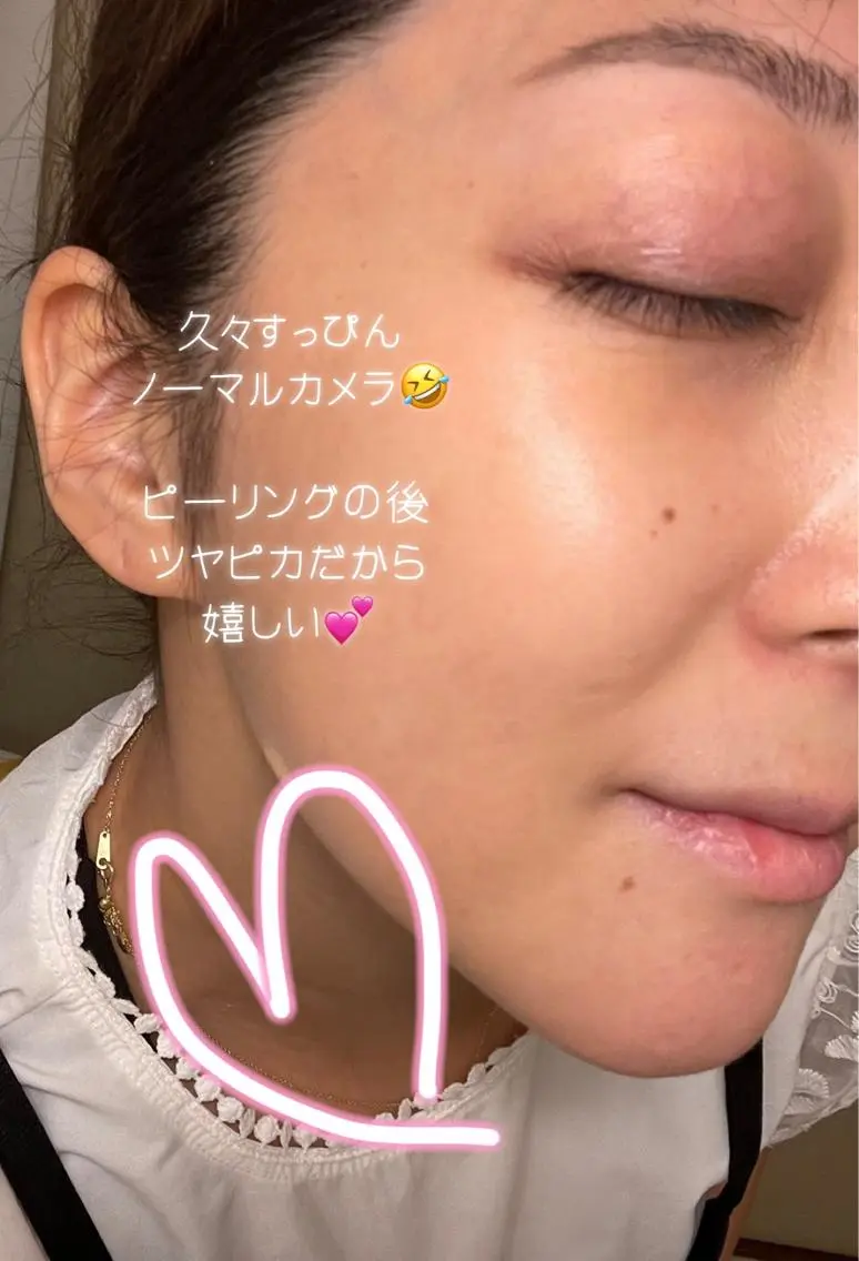 その他 アロマ•ピーリング SalonYokoのその他イメージ