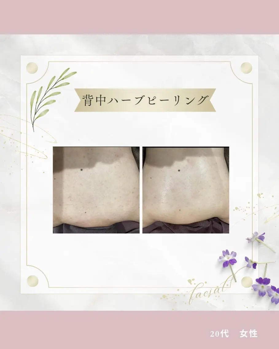 《 肌質×美肌 》 addissimoのエステ・リラクイメージ
