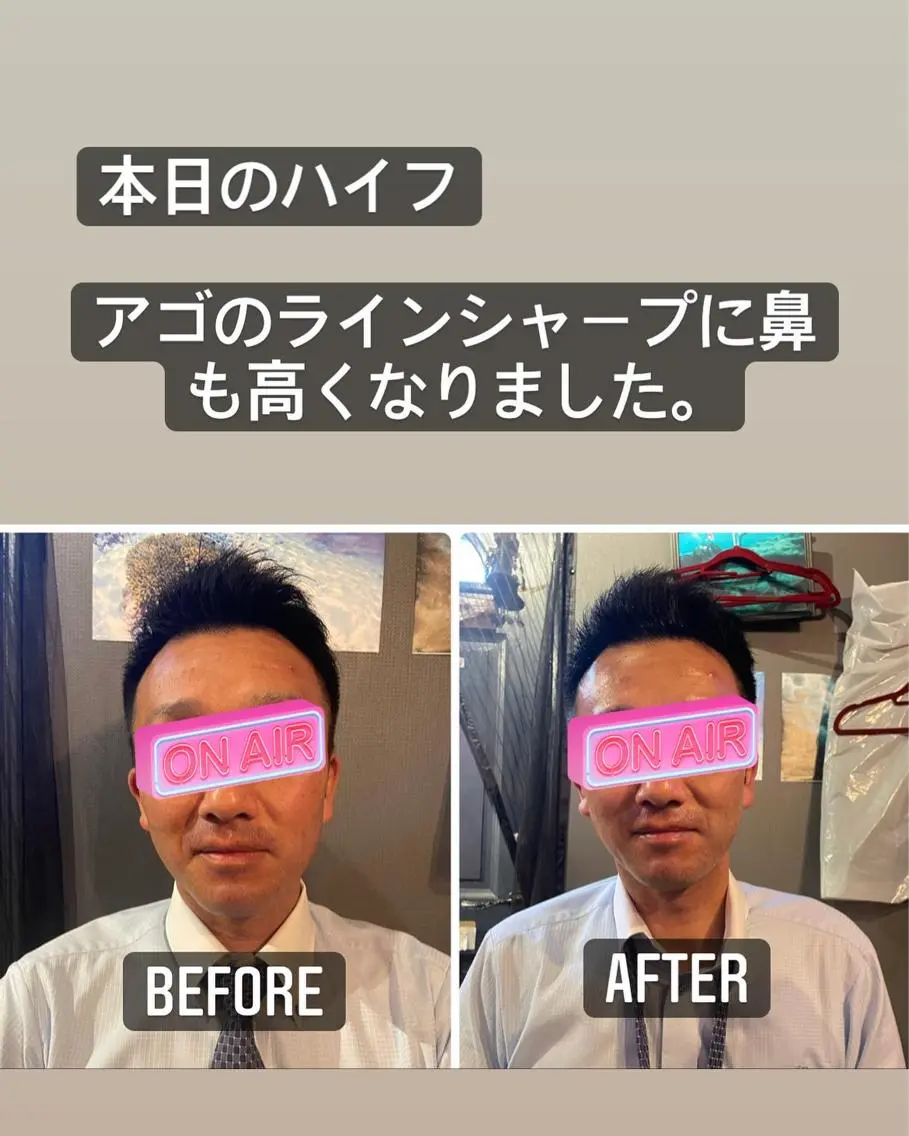 メンズ CRAZY NAILのネイルデザイン