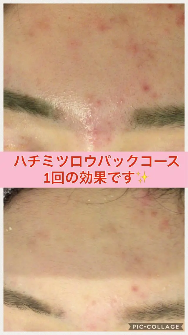 ショート カラー パーマ ヘアアレンジ メンズ キッズ ネイル マツエク・マツパ 赤色 ニキビ・肌質改善専門 ♡人生が変わるサロンのエステ・リラクイメージ
