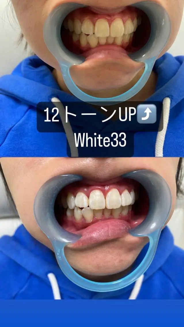 メンズ メンズパーマ セルフホワイトニング White33大名のその他イメージ