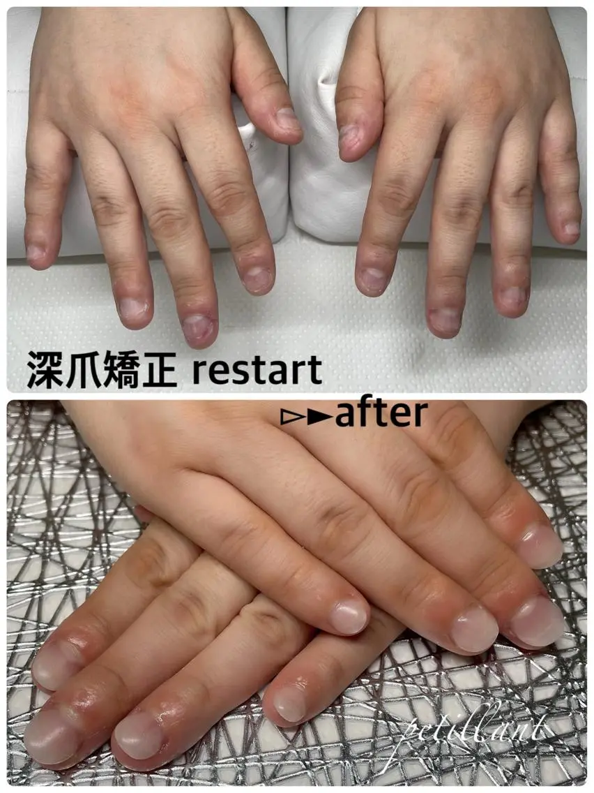 ネイル nail salon petillantのネイルデザイン