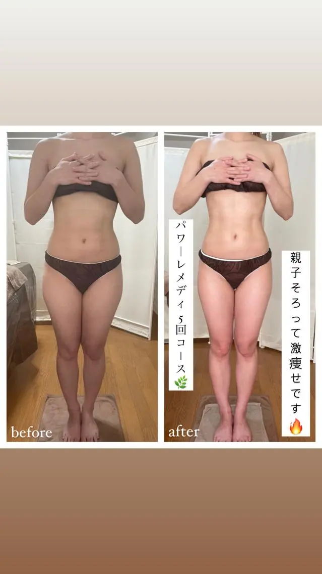 《本気痩せ×疲労改善 》 BILOOPのエステ・リラクイメージ