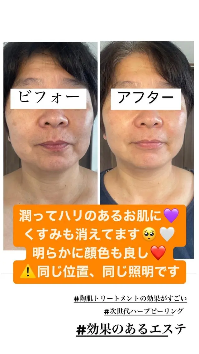 エステ 肌育脱毛サロン LikoLinaのその他イメージ