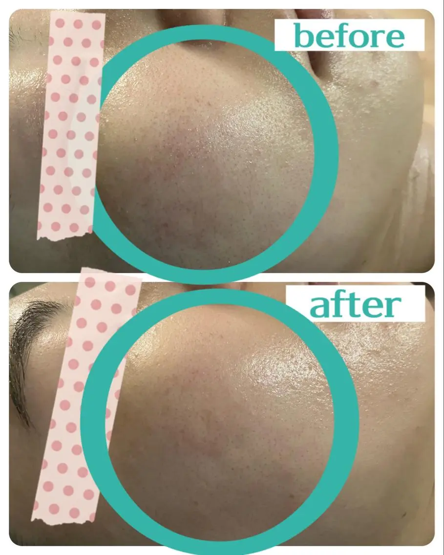 エステ LUANA 美肌脱毛＋Skinのエステ・リラクイメージ