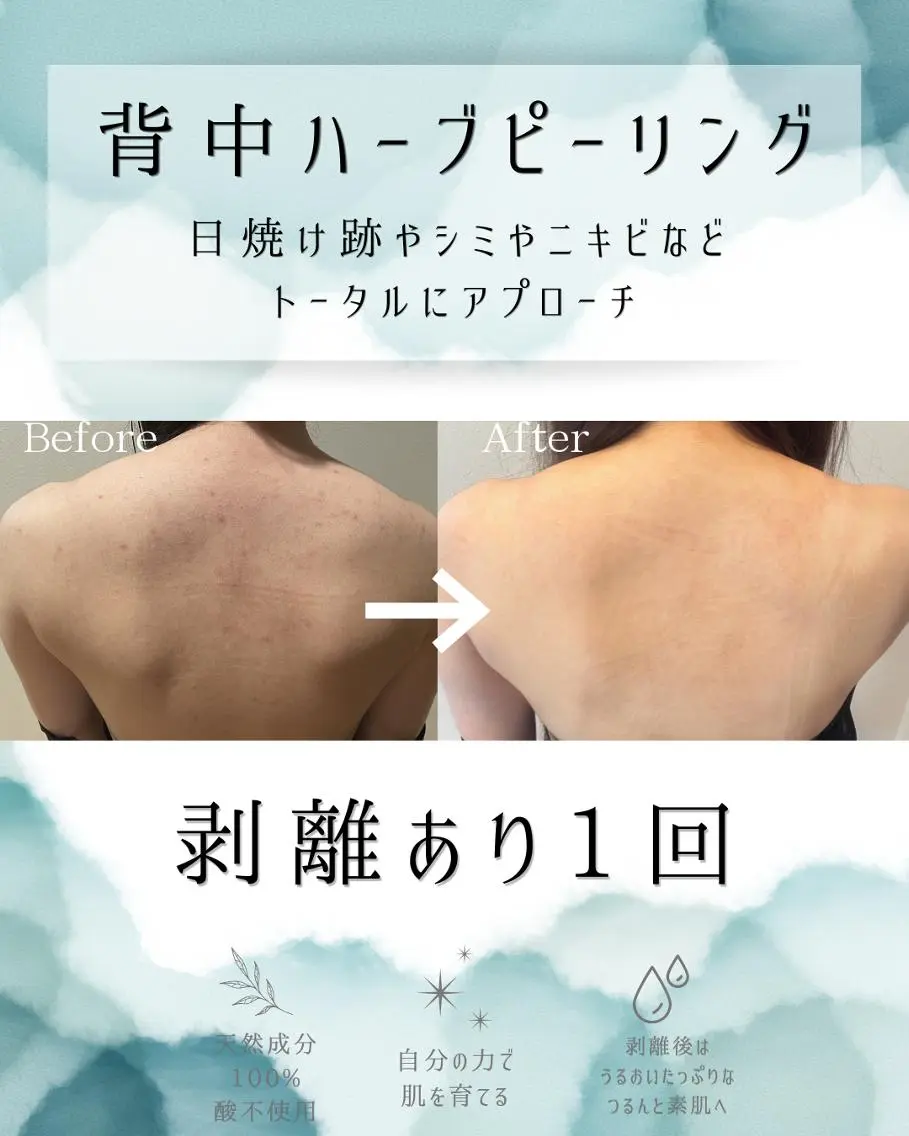 エステ リラク 医療提携 肌管理痩身エステ池袋のエステ・リラクイメージ