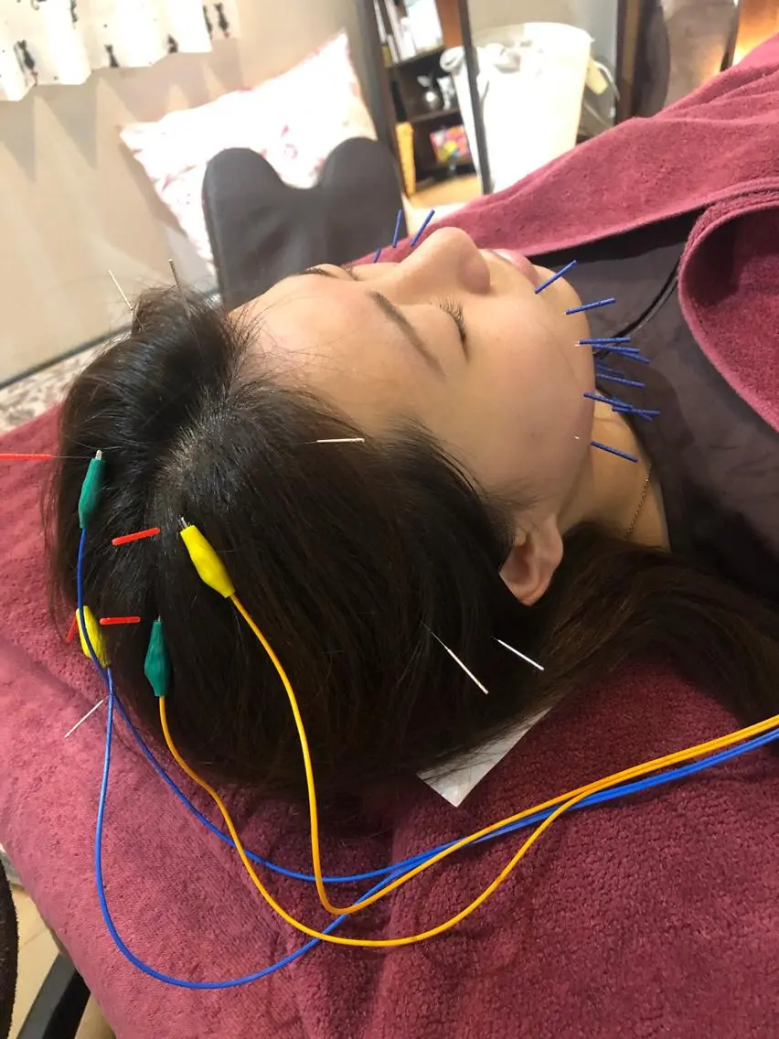 エステ リラク 美容鍼灸女性専用 りんご鍼灸治療院のその他イメージ