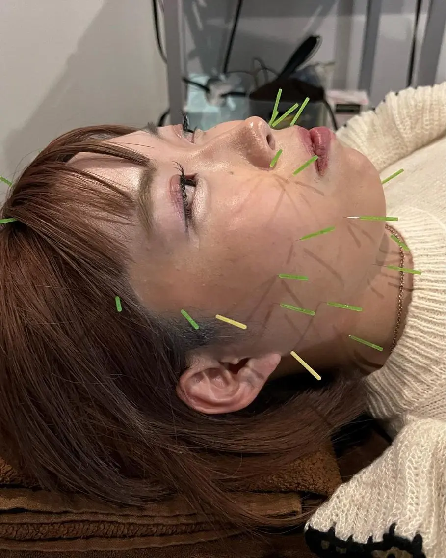 メンズ エステ リラク 美容鍼灸サロン LOMIHARIのエステ・リラクイメージ