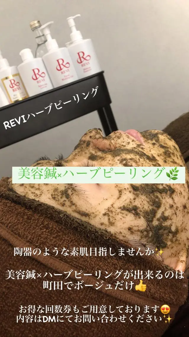 エステ 小顔矯/美容鍼/鍼灸 BeauJuのその他イメージ