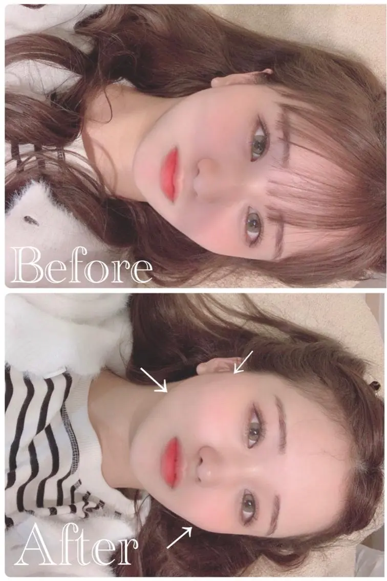 鍼灸 Refineのその他イメージ