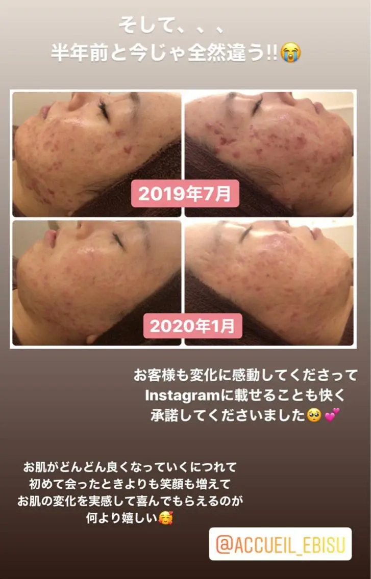 ミディアム カラー パーマ ヘアアレンジ メンズ キッズ ネイル マツエク・マツパ エステ リラク ニキビ・肌質改善専門 ♡人生が変わるサロンのエステ・リラクイメージ