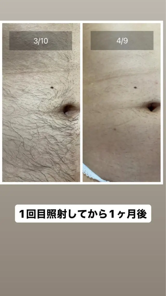 メンズ salon rosariumのエステ・リラクイメージ