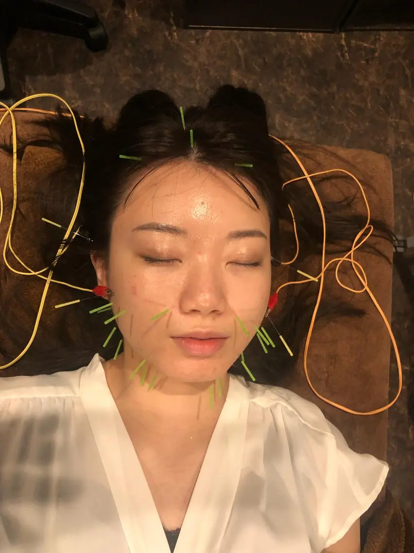 メンズ エステ リラク 美容鍼灸サロン LOMIHARIのエステ・リラクイメージ