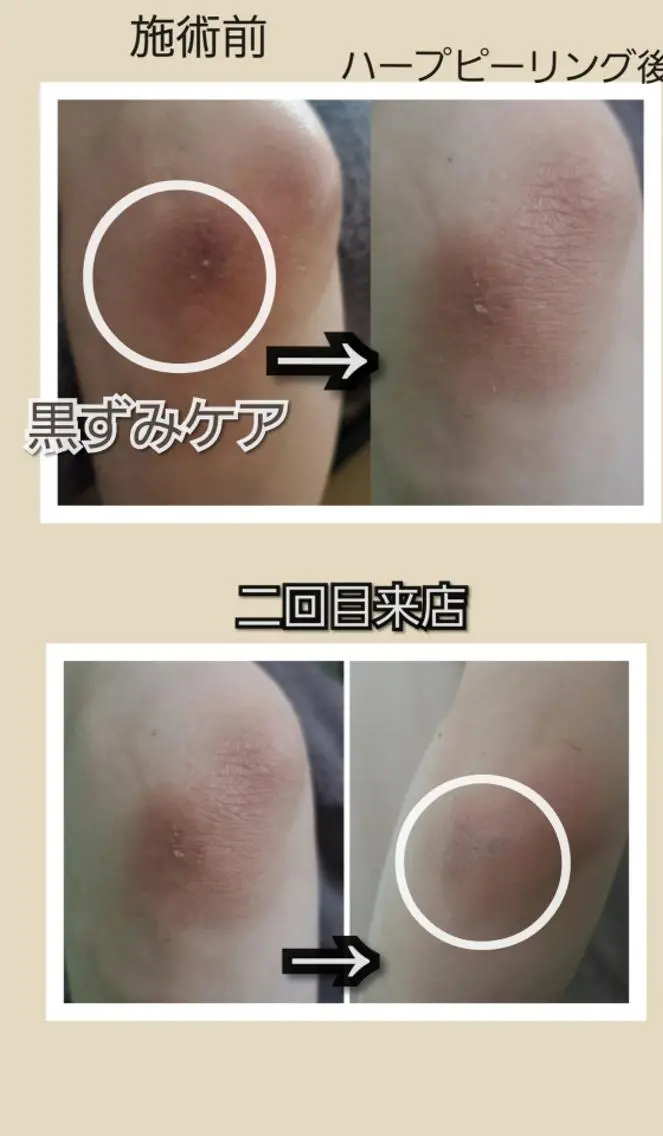 エステ face&body mori'sroomのエステ・リラクイメージ