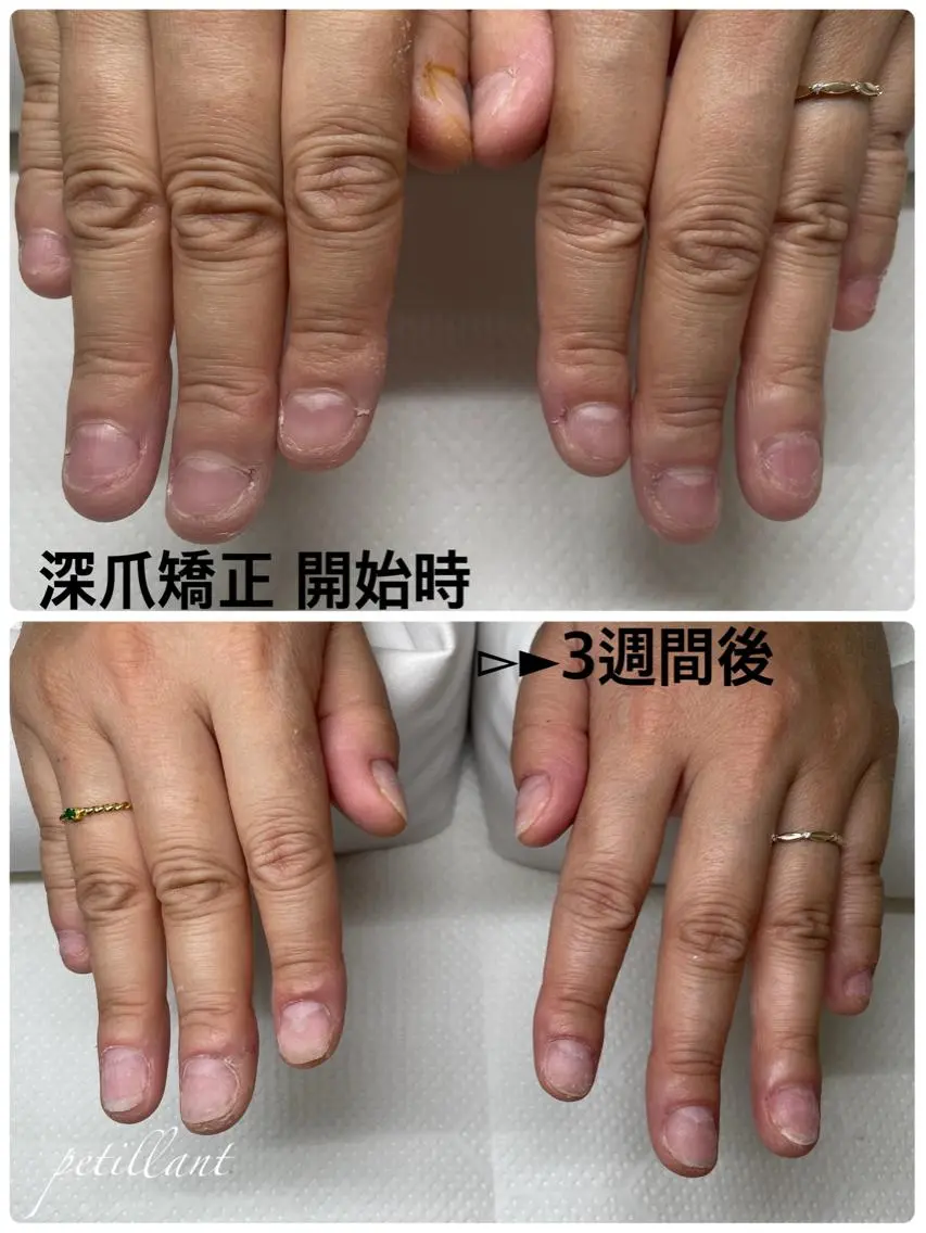 ネイル ピンク nail salon petillantのネイルデザイン