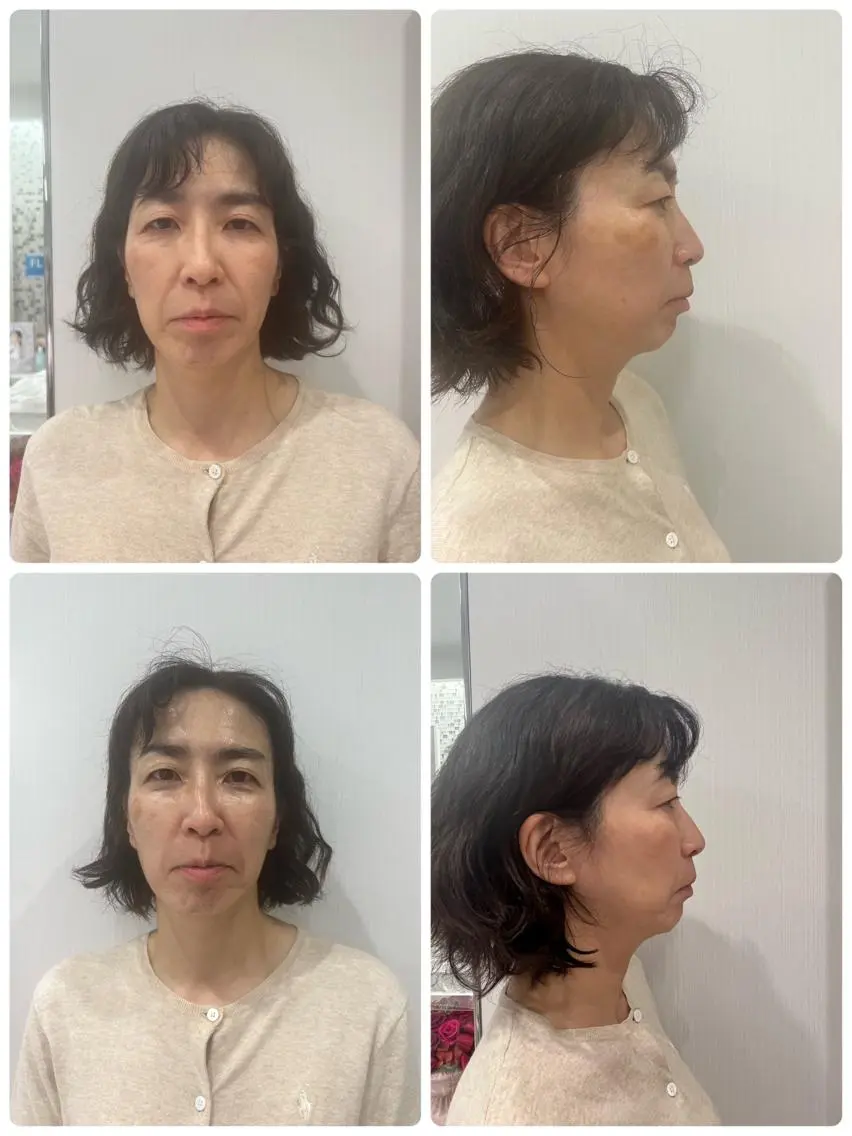 丸の内ヒルズ 今井琴恵のエステ・リラクイメージ