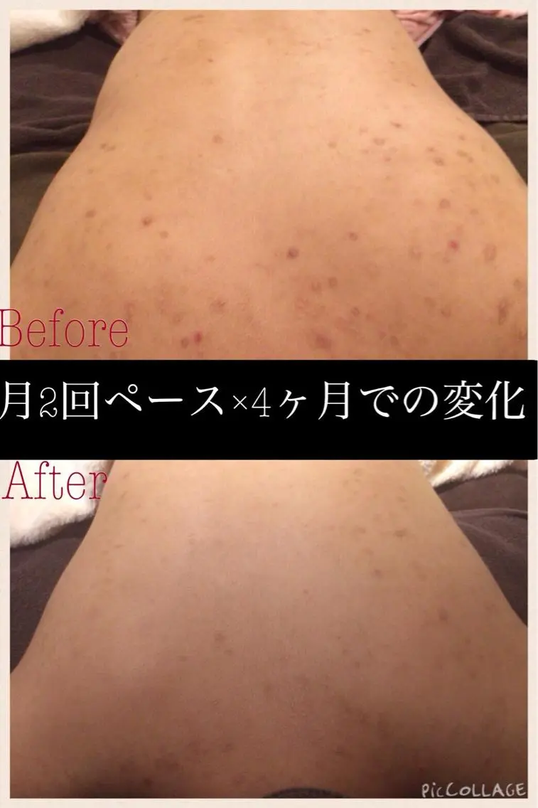 ミディアム カラー パーマ ヘアアレンジ メンズ キッズ ネイル マツエク・マツパ エステ リラク ニキビ・肌質改善専門 ♡人生が変わるサロンのエステ・リラクイメージ