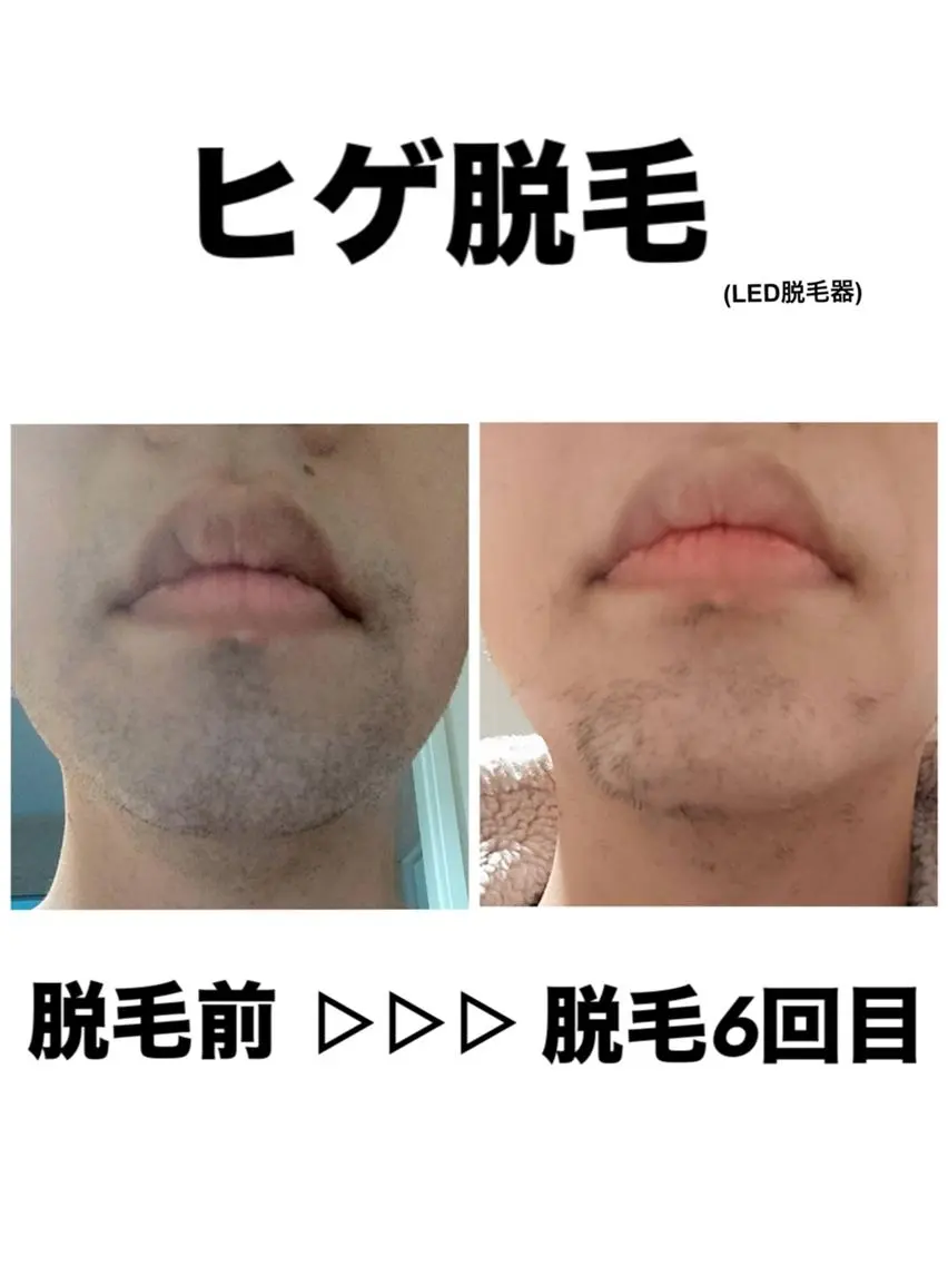 脱毛 脱毛・眉毛・フェイス サロンN久留米店の眉毛・アイブロウイメージ