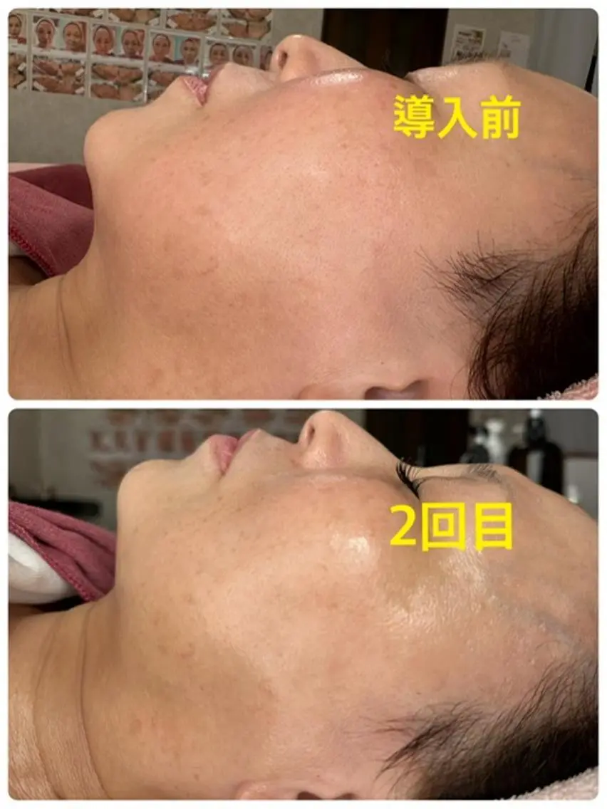 Lien オーナー 山口智嘉のエステ・リラクイメージ
