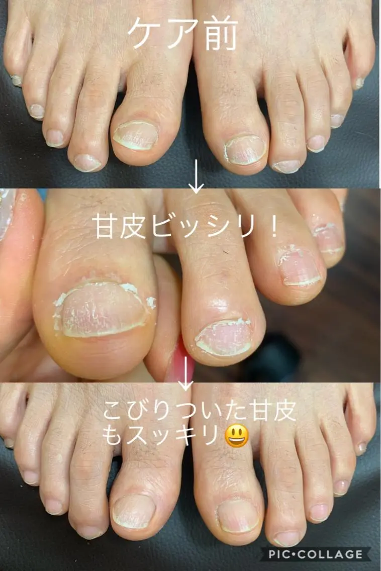 ネイル フットネイル salon Noelのネイルデザイン
