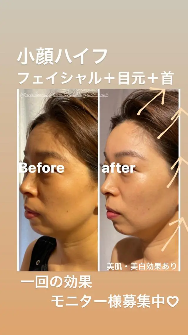 ミディアム カラー パーマ ヘアアレンジ メンズ キッズ ネイル マツエク・マツパ ルシール ユーのエステ・リラクイメージ