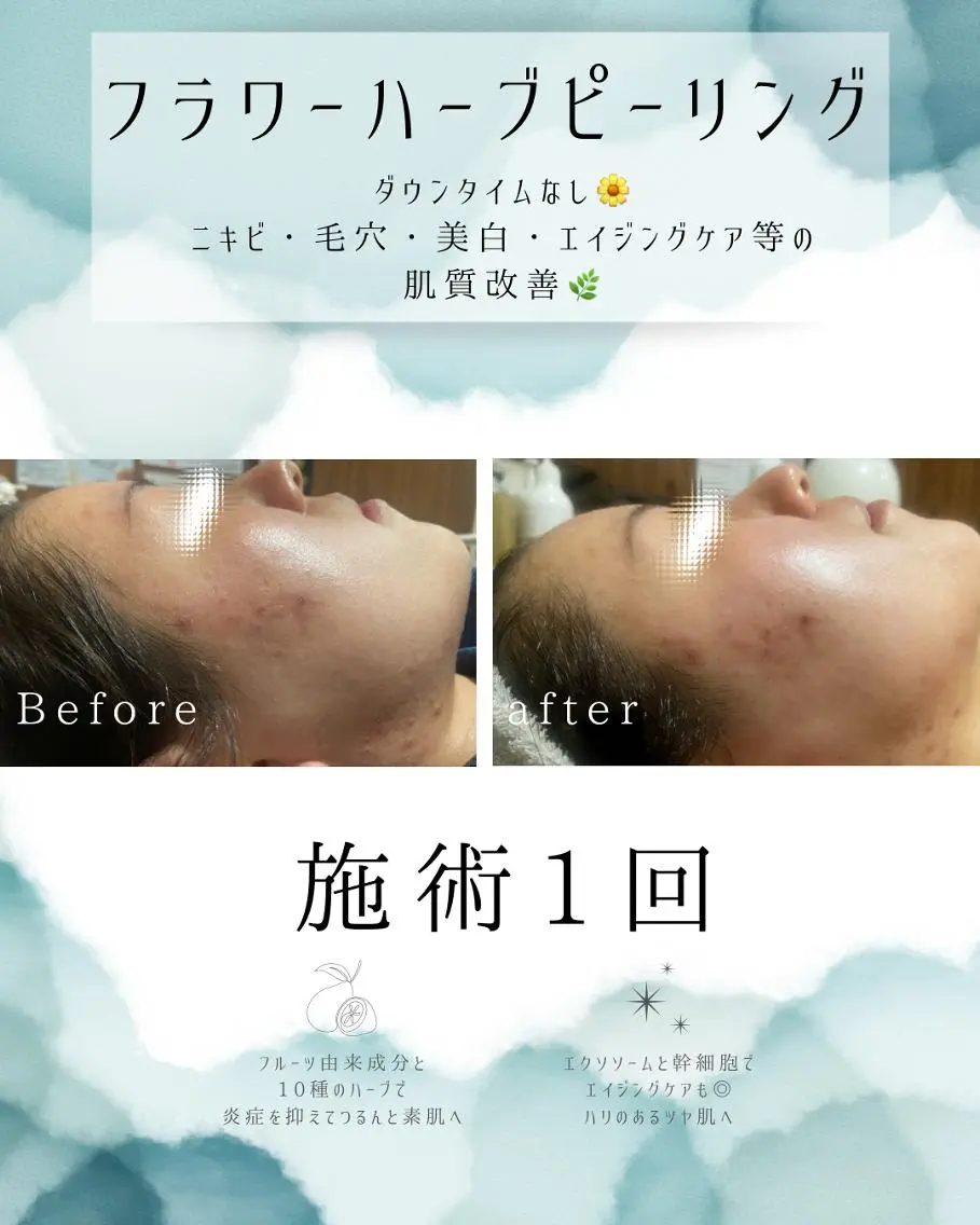 エステ リラク 医療提携 肌管理痩身エステ池袋のエステ・リラクイメージ