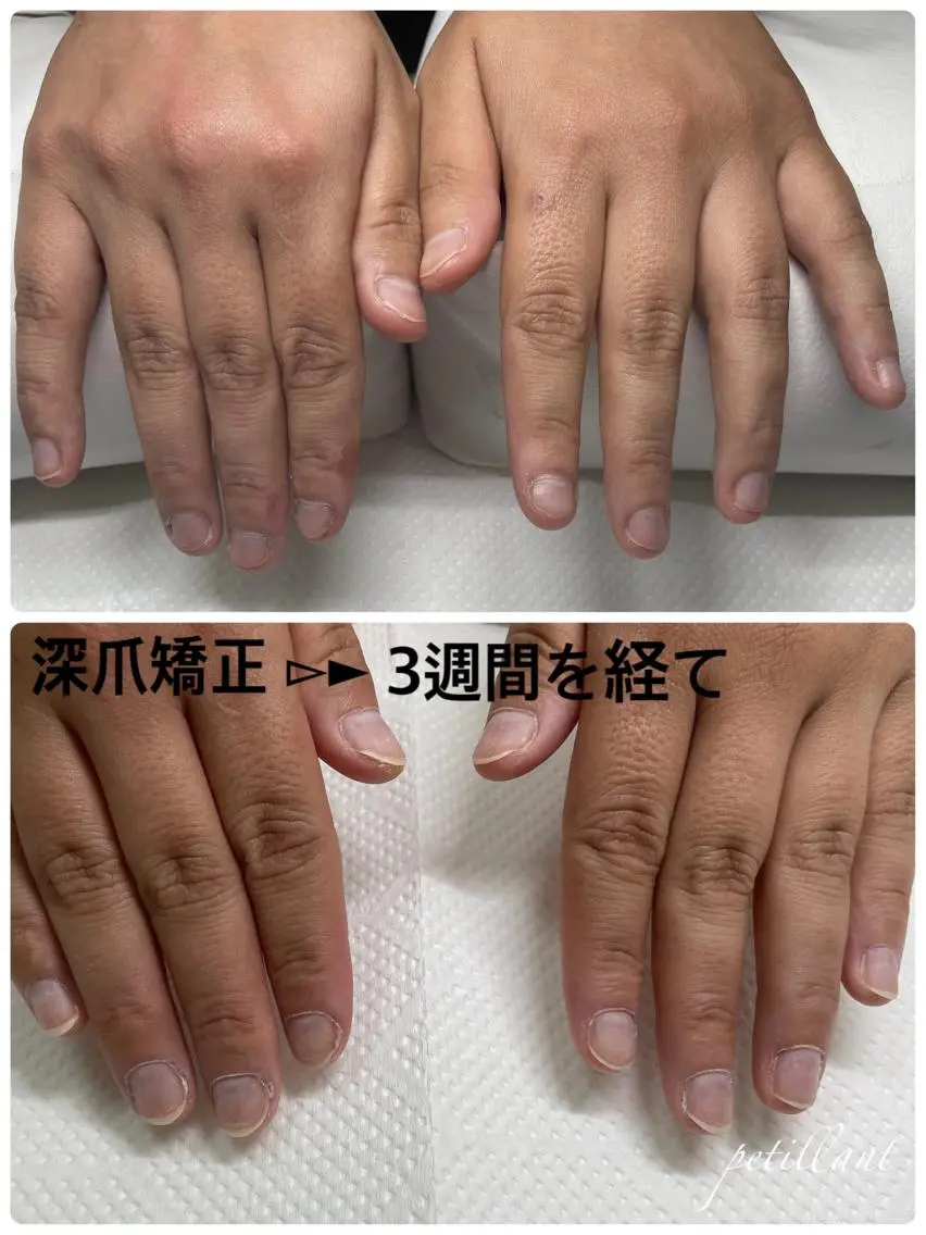 ネイル 長さ出し ジェルネイル nail salon petillantのネイルデザイン