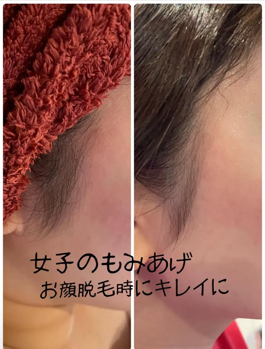 脱毛サロン mamanaのエステ・リラクイメージ