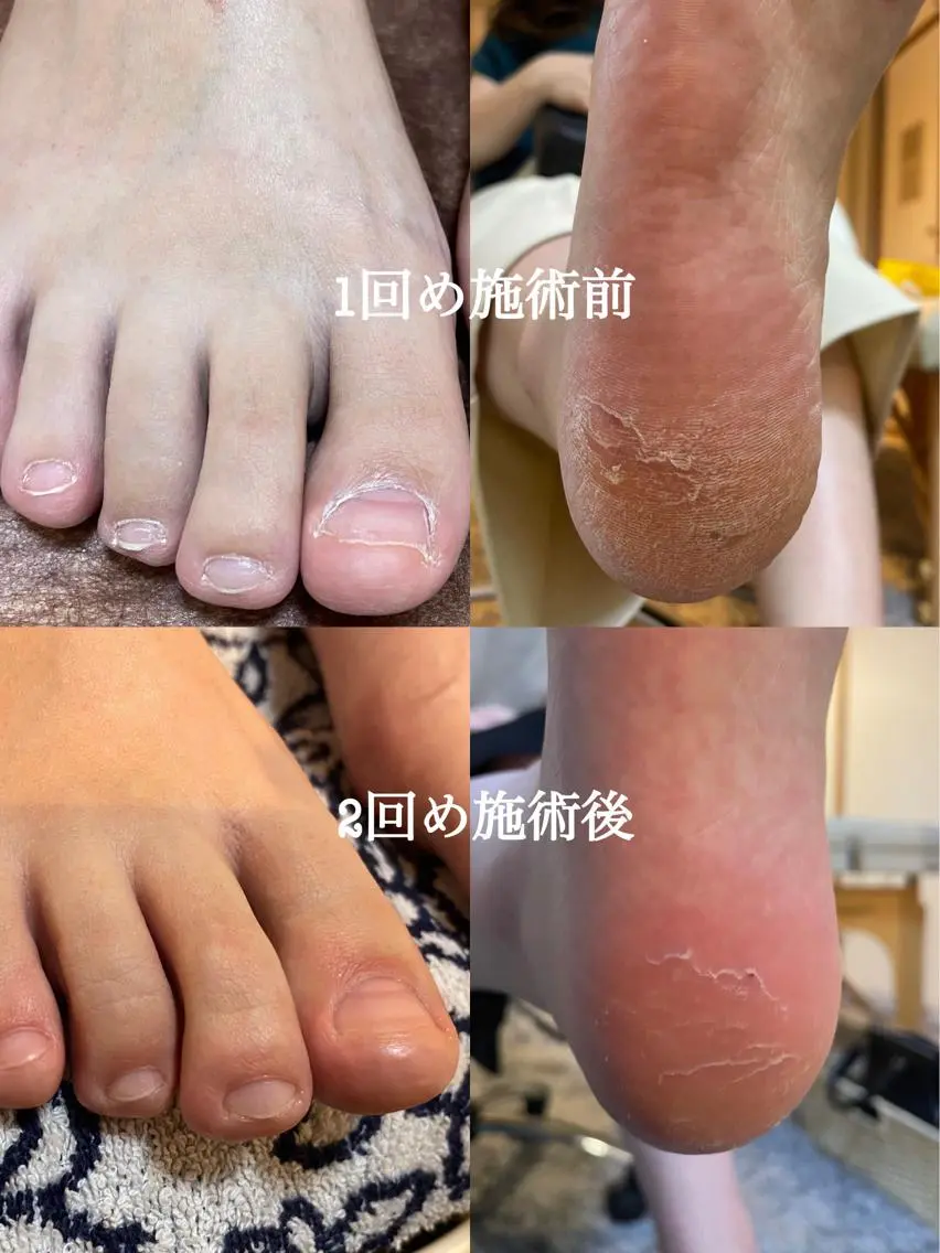 メンズ ネイル フットネイル たちばな ✋🦶💆♀️のネイルデザイン