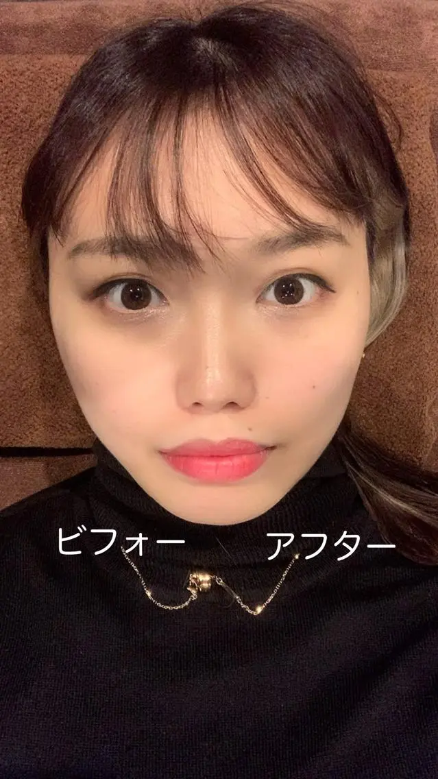 メンズ エステ リラク 美容鍼灸サロン LOMIHARIのエステ・リラクイメージ