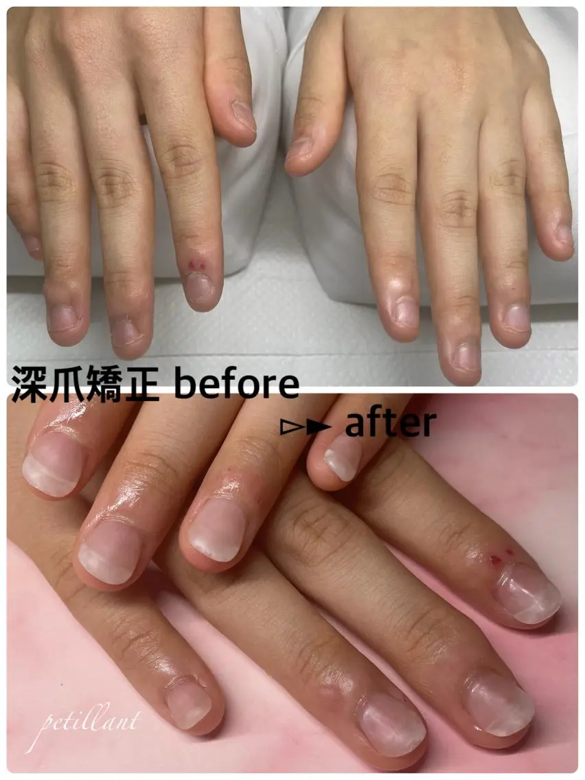 ネイル クリアネイル マットネイル nail salon petillantのネイルデザイン