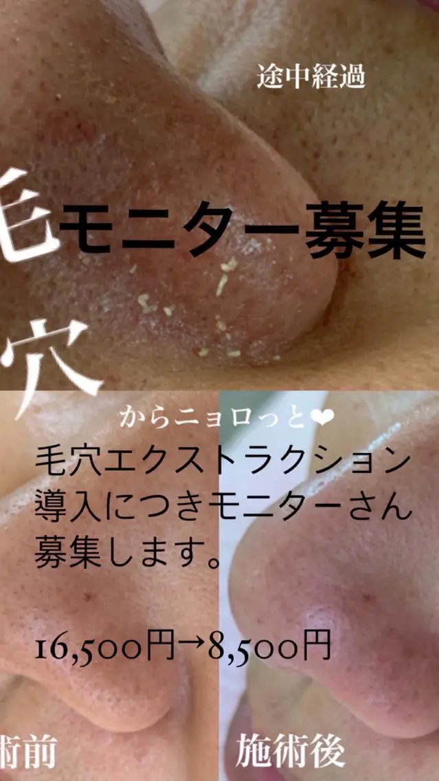 メンズ 大倉 るるなのエステ・リラクイメージ