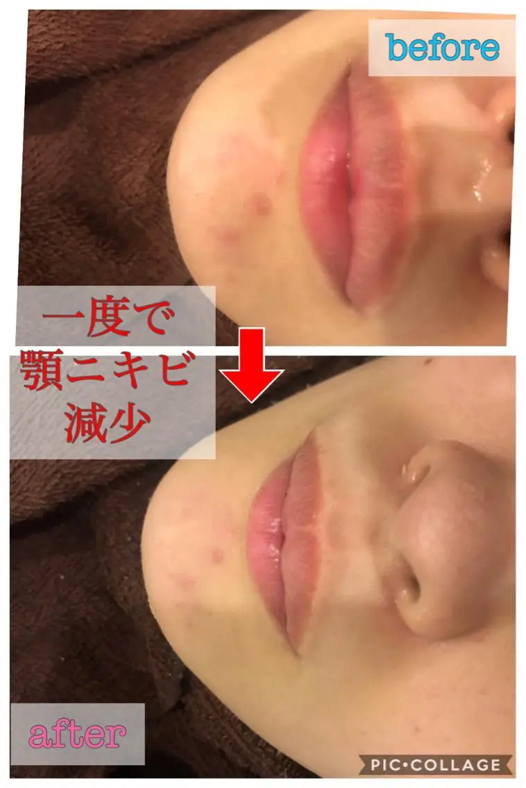 セミロング カラー パーマ ヘアアレンジ メンズ キッズ ネイル マツエク・マツパ 金の糸脱毛 産毛ケア専門のエステ・リラクイメージ
