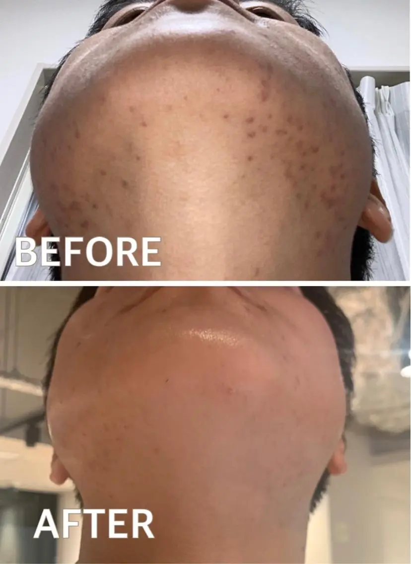 メンズ 大阪脱毛|ちぇるま| 眉毛Wax｜美肌管理のエステ・リラクイメージ