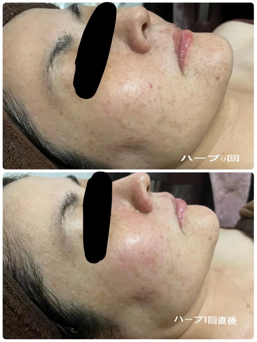 SALON BioBioのエステ・リラクイメージ