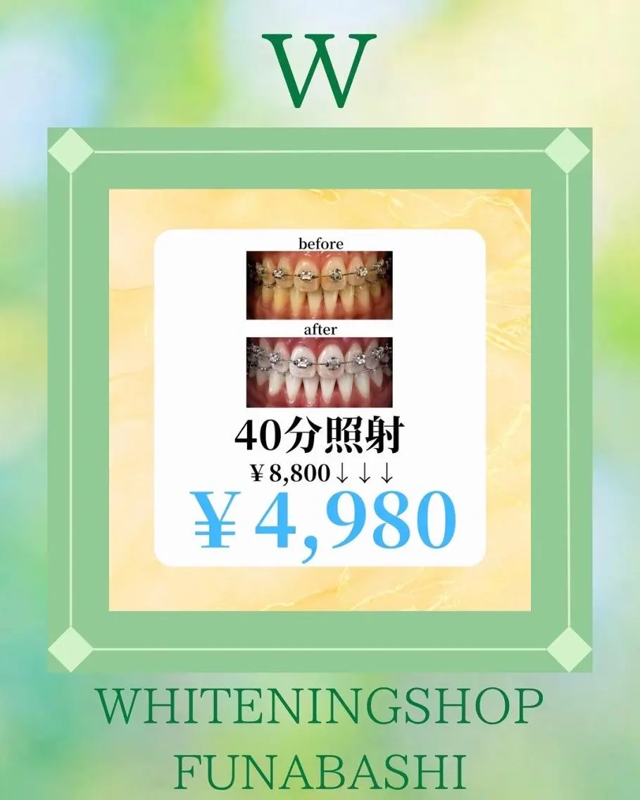 ホワイトニング ショップ船橋店🦷のエステ・リラクイメージ