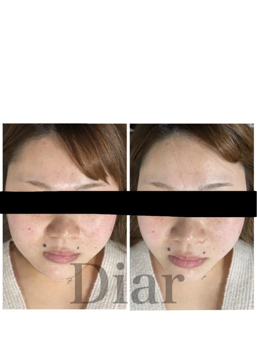 Diar salonのその他イメージ
