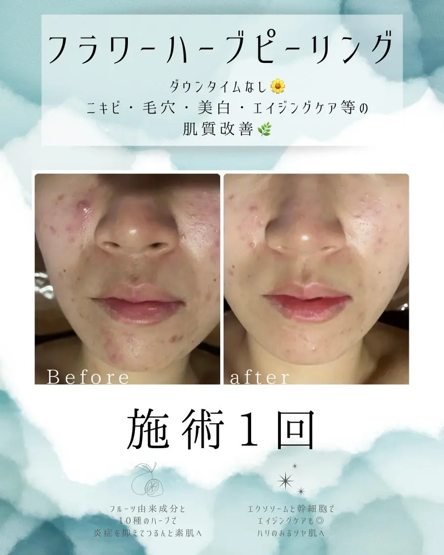 エステ リラク 医療提携 肌管理痩身エステ池袋のエステ・リラクイメージ
