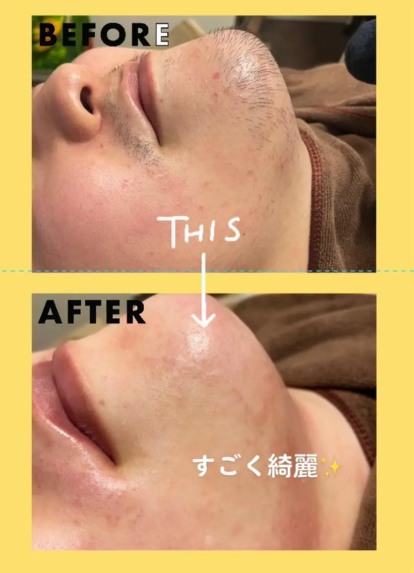 メンズ 河上★うなじや首回り Wax脱毛が得意ですのエステ・リラクイメージ