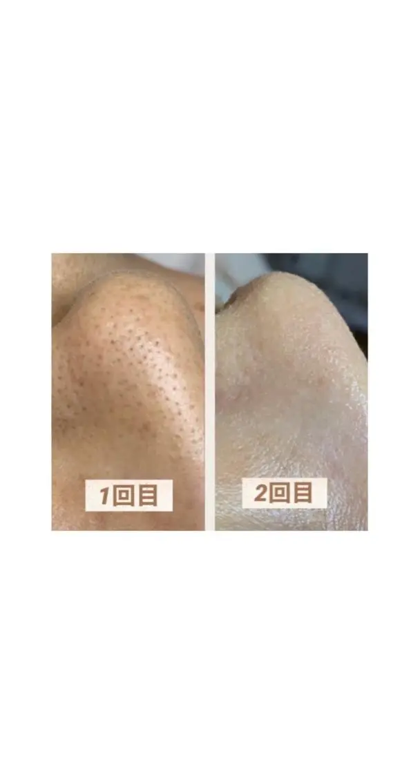 松下 千恵のネイルデザイン