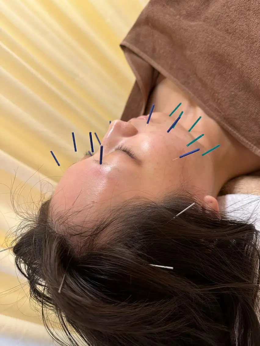 鍼灸サロン BBB3のその他イメージ