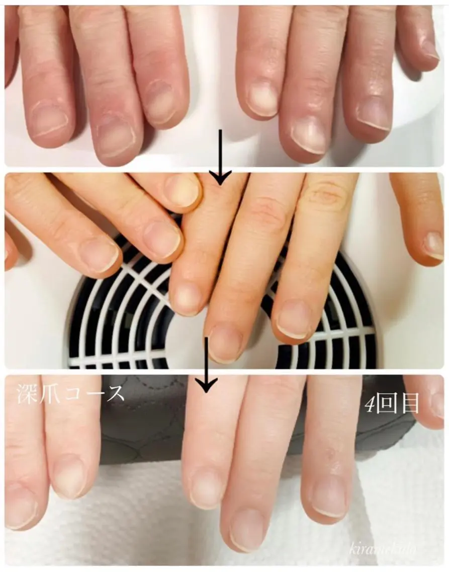 ネイル ハンドネイル 林 禅のネイルデザイン