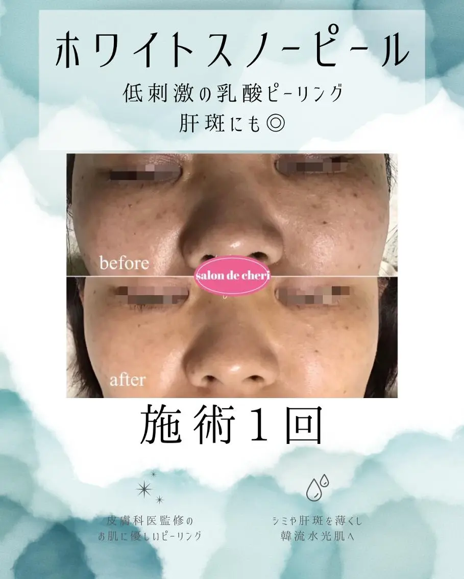 エステ リラク 医療提携 肌管理痩身エステ池袋のエステ・リラクイメージ