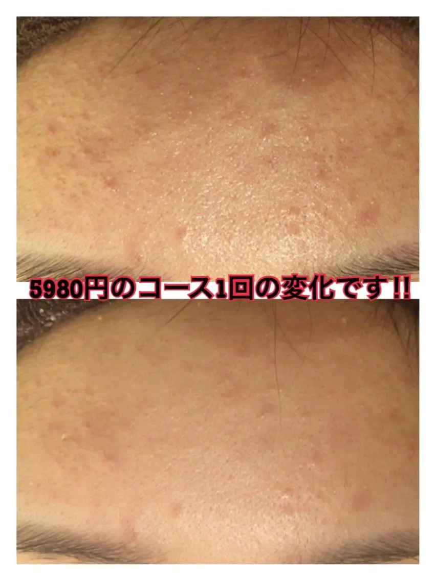 ショート カラー パーマ ヘアアレンジ メンズ キッズ ネイル マツエク・マツパ ニキビ・肌質改善専門 ♡人生が変わるサロンのエステ・リラクイメージ