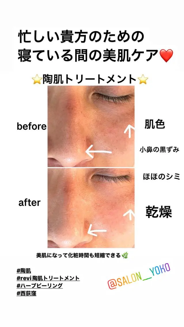 その他 アロマ•ピーリング SalonYokoのその他イメージ