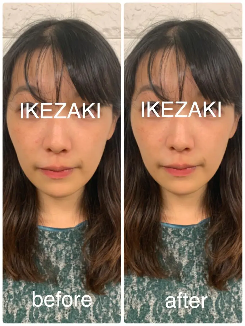 美容鍼 IKEZAKIのエステ・リラクイメージ
