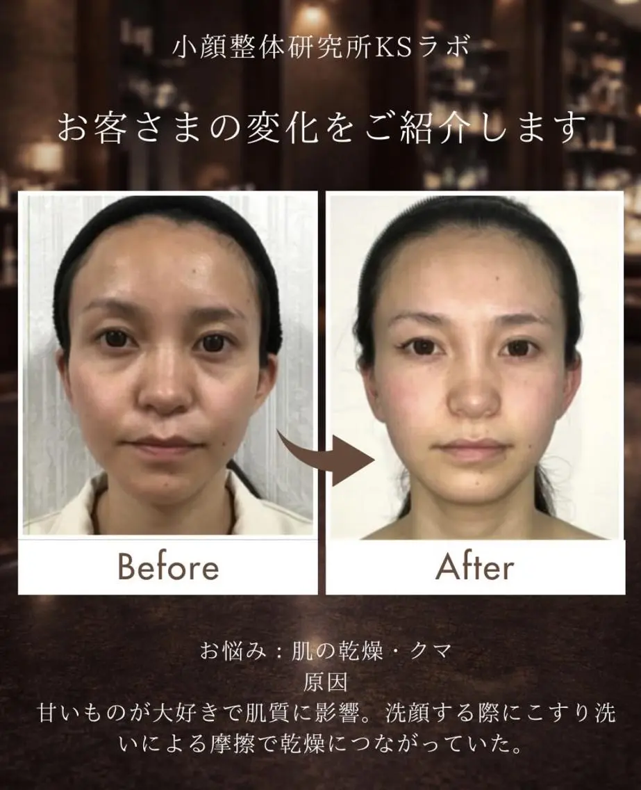 小顔整体研究所 KSラボ静岡店のエステ・リラクイメージ