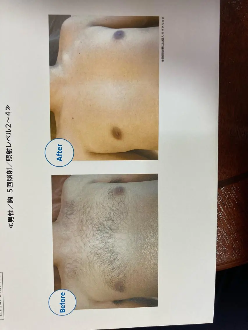 メンズ 脱毛 伊藤 幸子のエステ・リラクイメージ